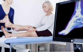 A Pooled Analysis of VitaminD Dose Requirements for Fracture Prevention