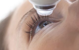 ClinicalTrial Secondary Analyses of the Effects of LuteinZeaxanthin on Age Related Macular Degeneration Progression AREDS
